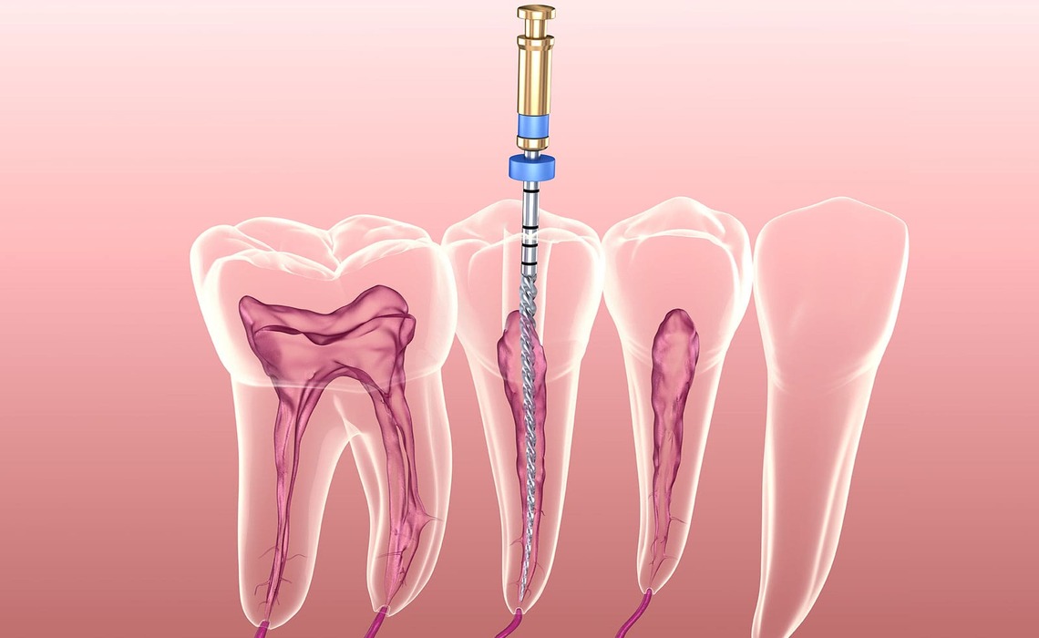 Endodonti